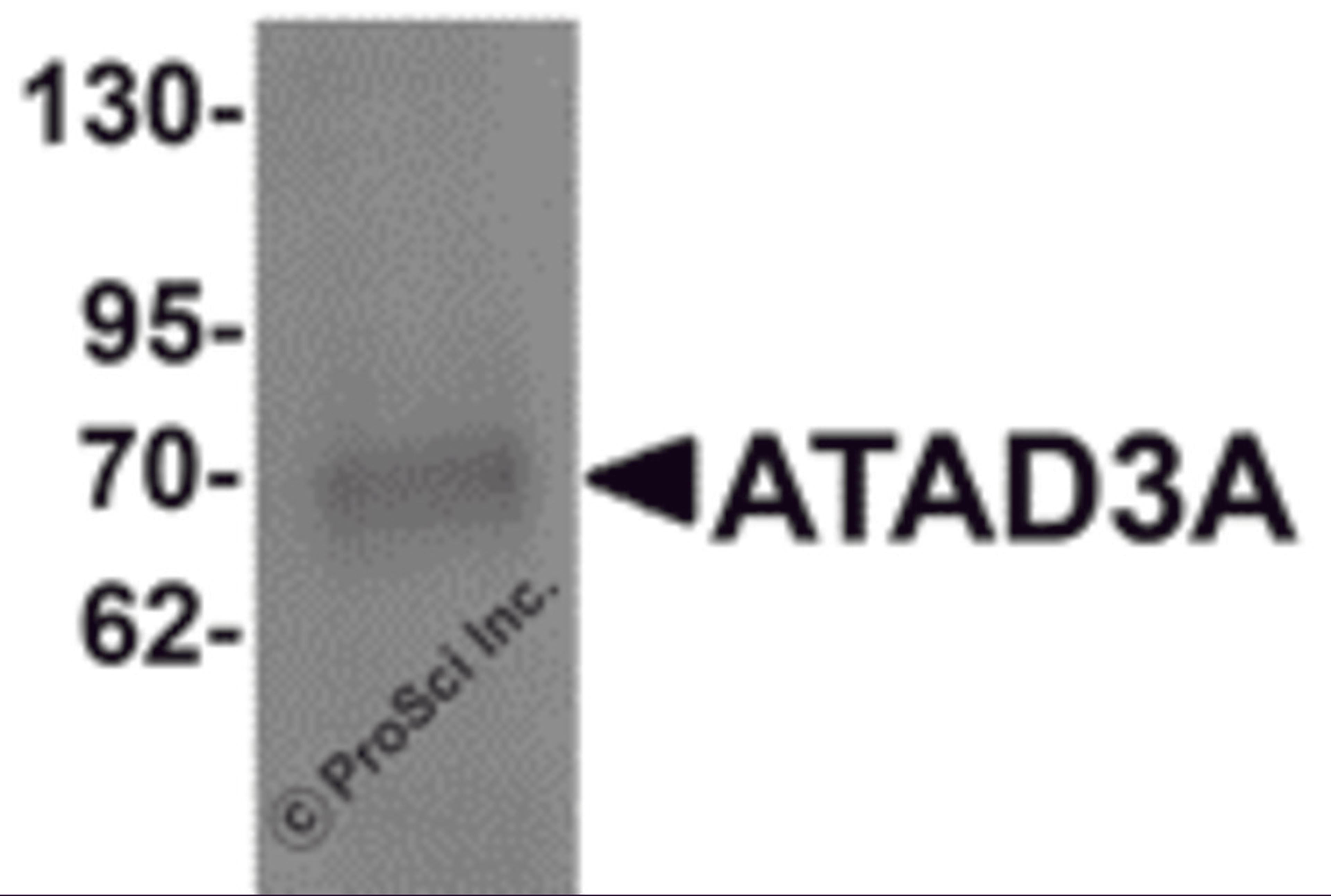 Western blot analysis of ATAD3A in Daudi cell lysate with ATAD3A antibody at 1 μg/mL .
