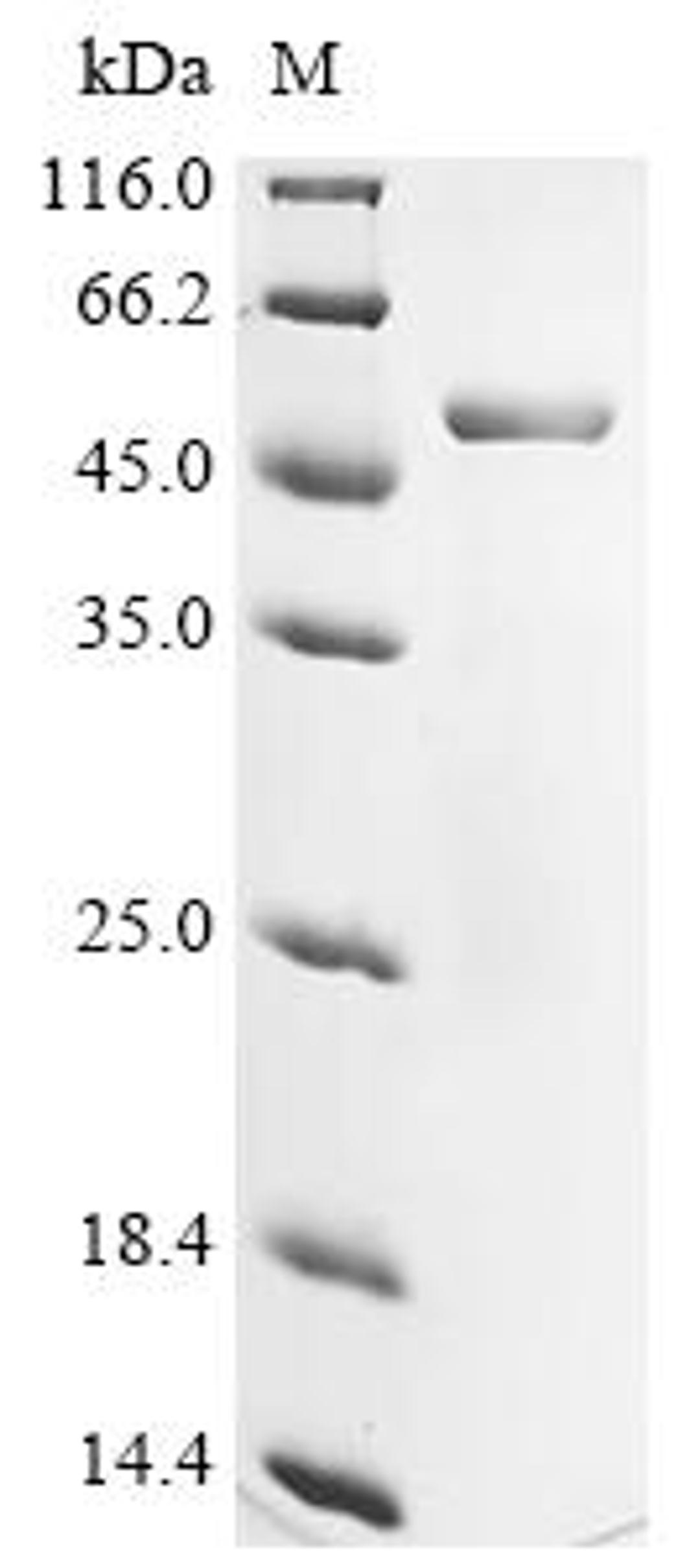 (Tris-Glycine gel) Discontinuous SDS-PAGE (reduced) with 5% enrichment gel and 15% separation gel.