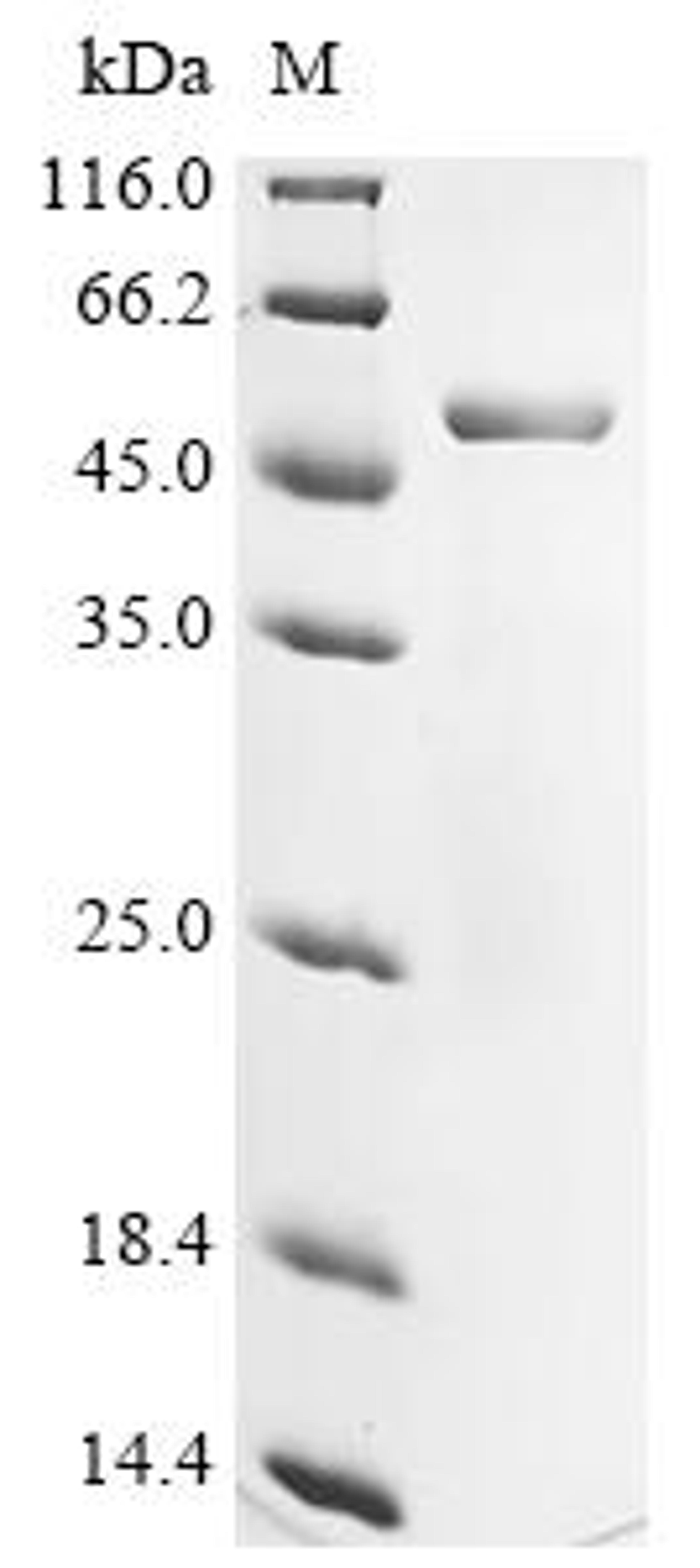 (Tris-Glycine gel) Discontinuous SDS-PAGE (reduced) with 5% enrichment gel and 15% separation gel.