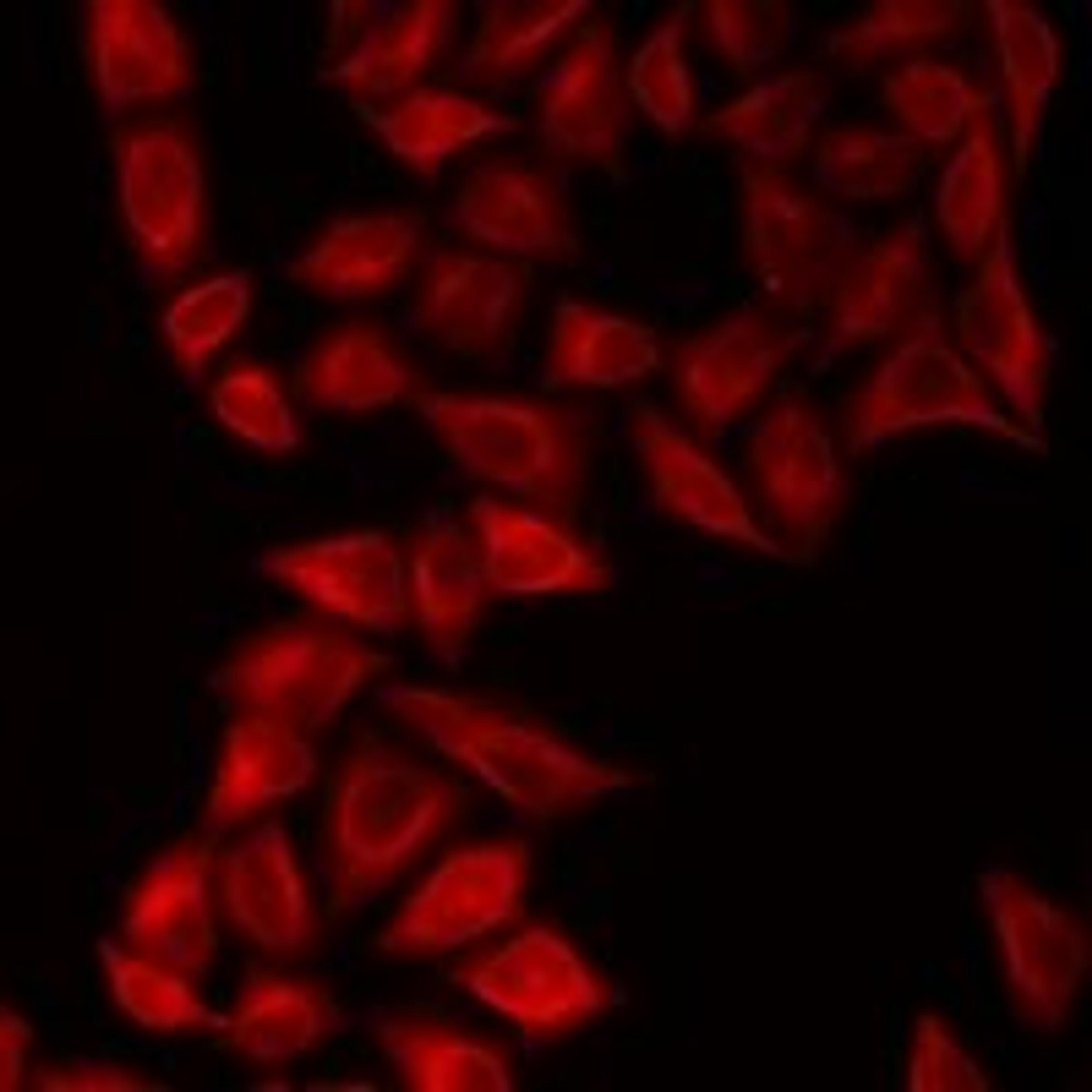 Immunofluorescent analysis of HeLa cells using NEIL1 antibody