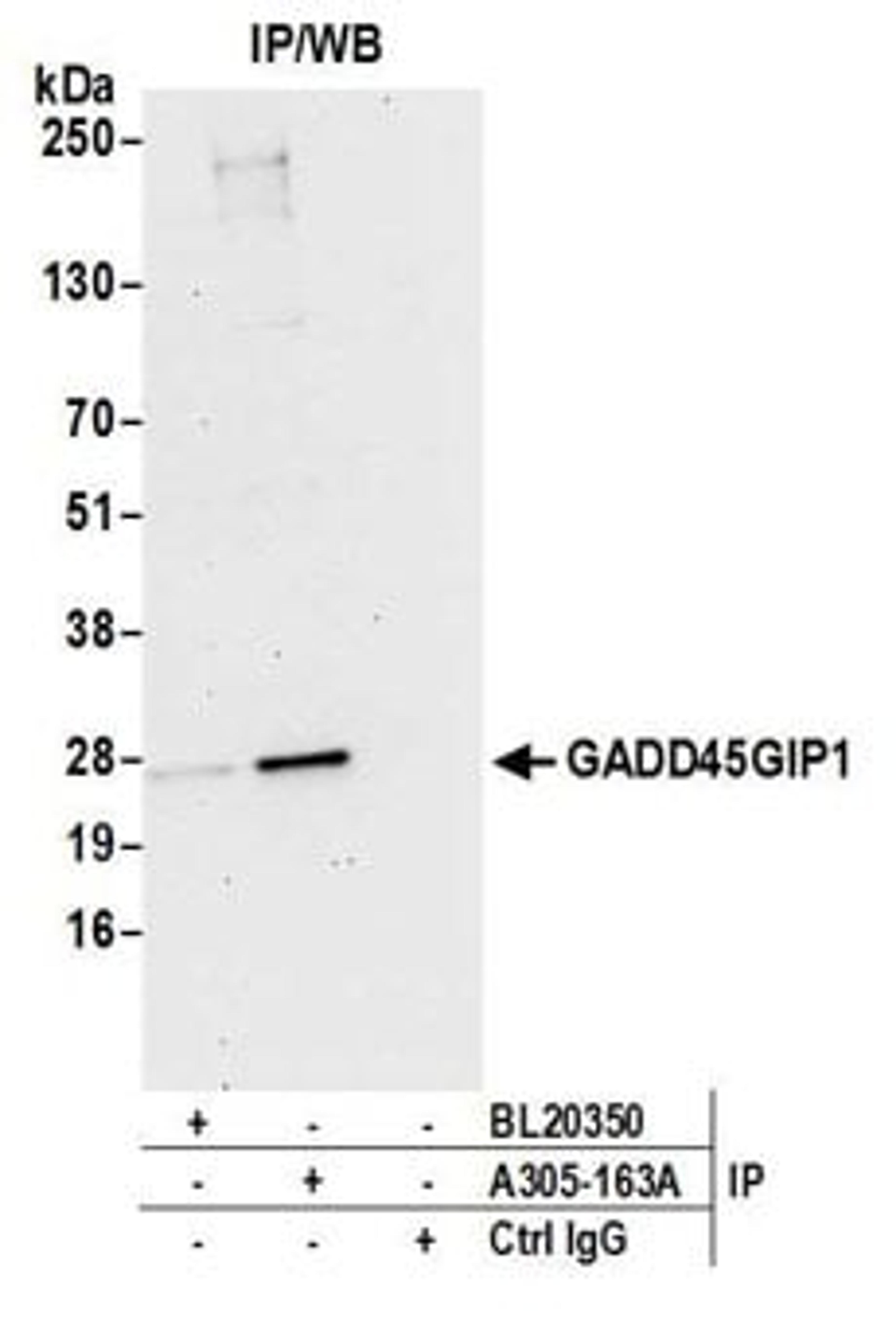 Detection of human GADD45GIP1 by western blot of immunoprecipitates.