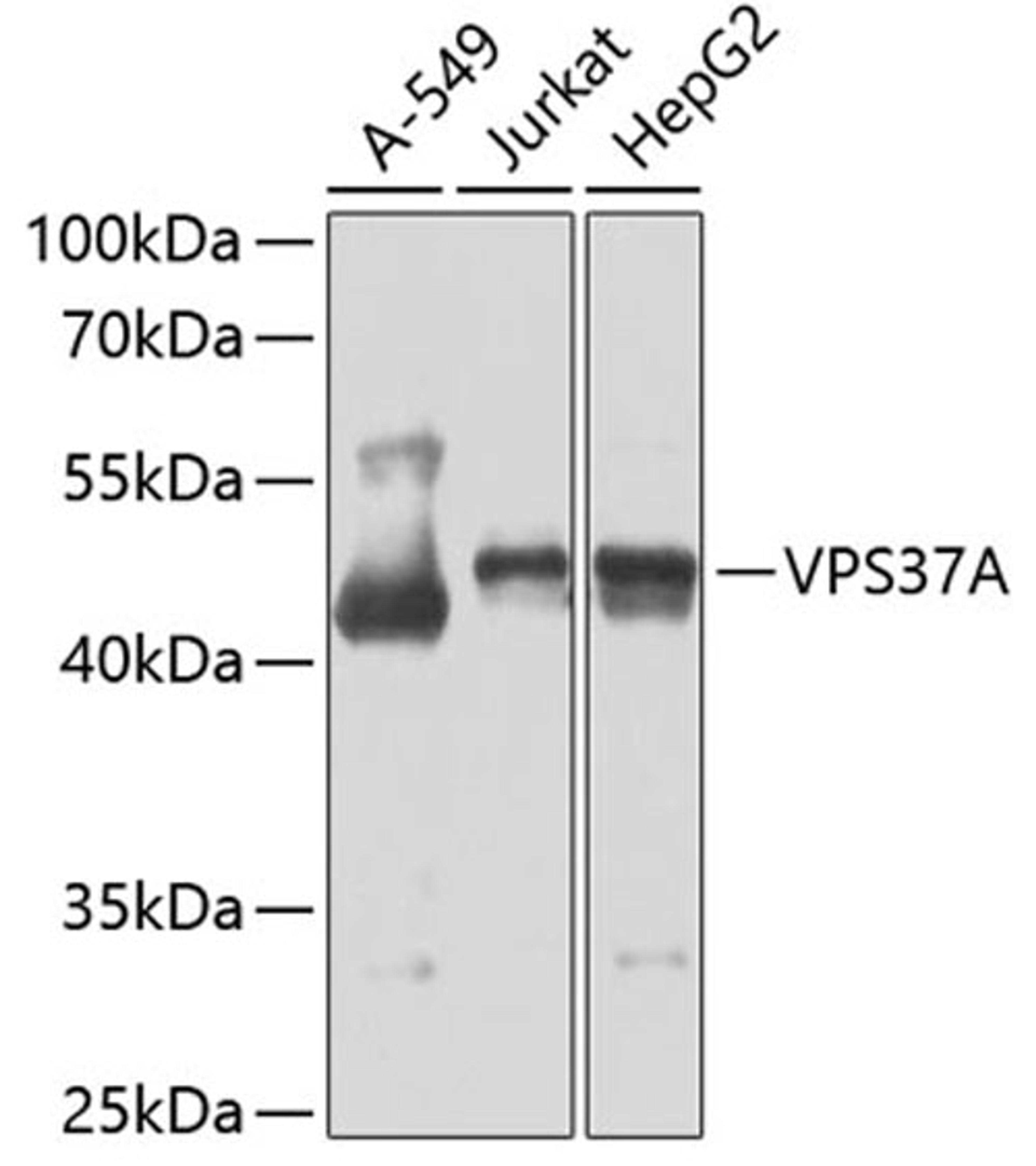 Western blot - VPS37A antibody (A7853)