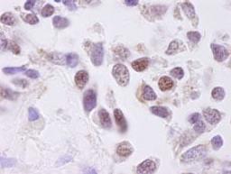 Detection of human CKII alpha by immunohistochemistry.