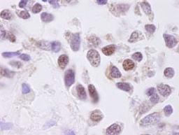 Detection of human CKII alpha by immunohistochemistry.