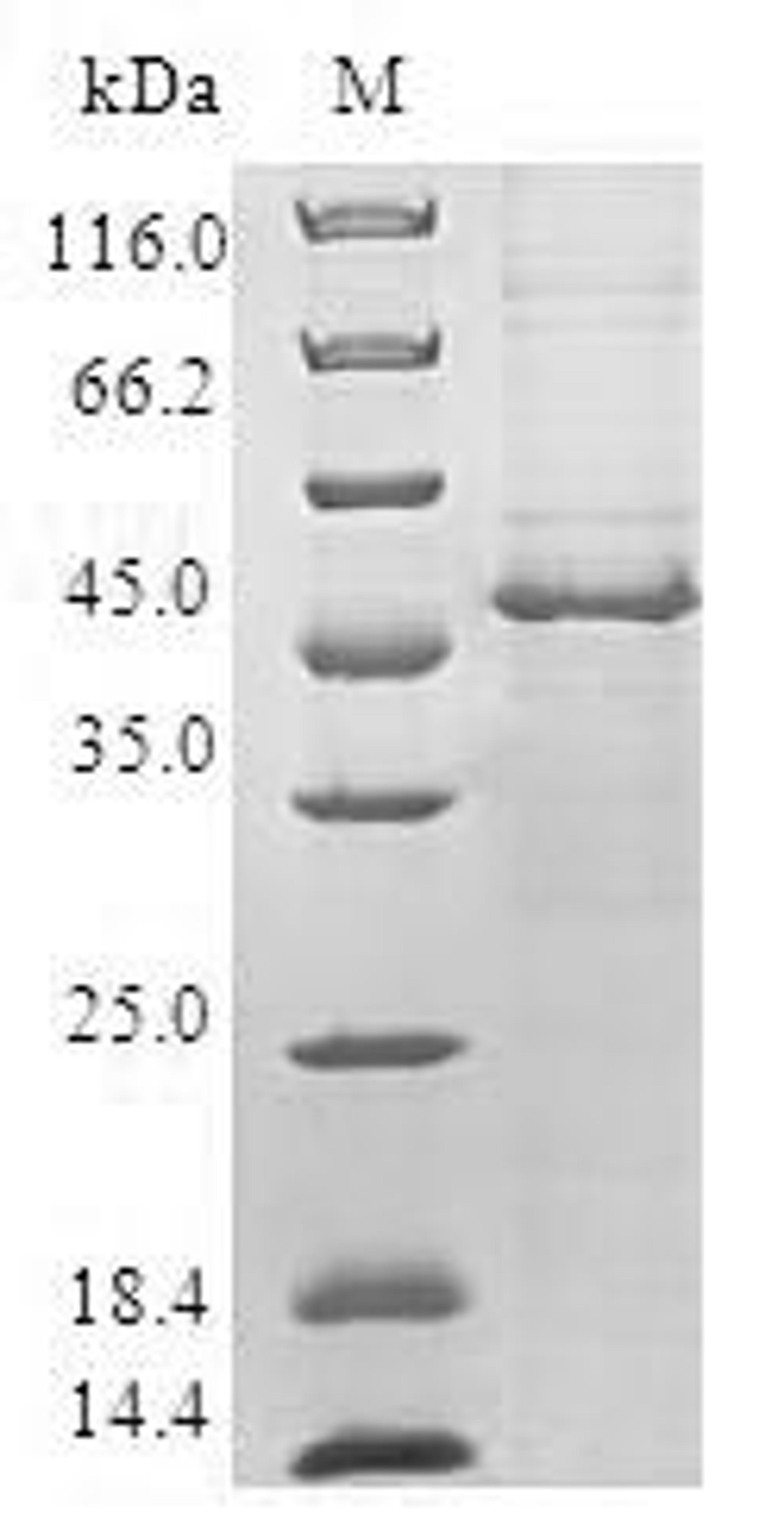 (Tris-Glycine gel) Discontinuous SDS-PAGE (reduced) with 5% enrichment gel and 15% separation gel.