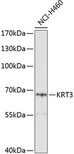 Western blot - KRT3 Antibody (A10118)