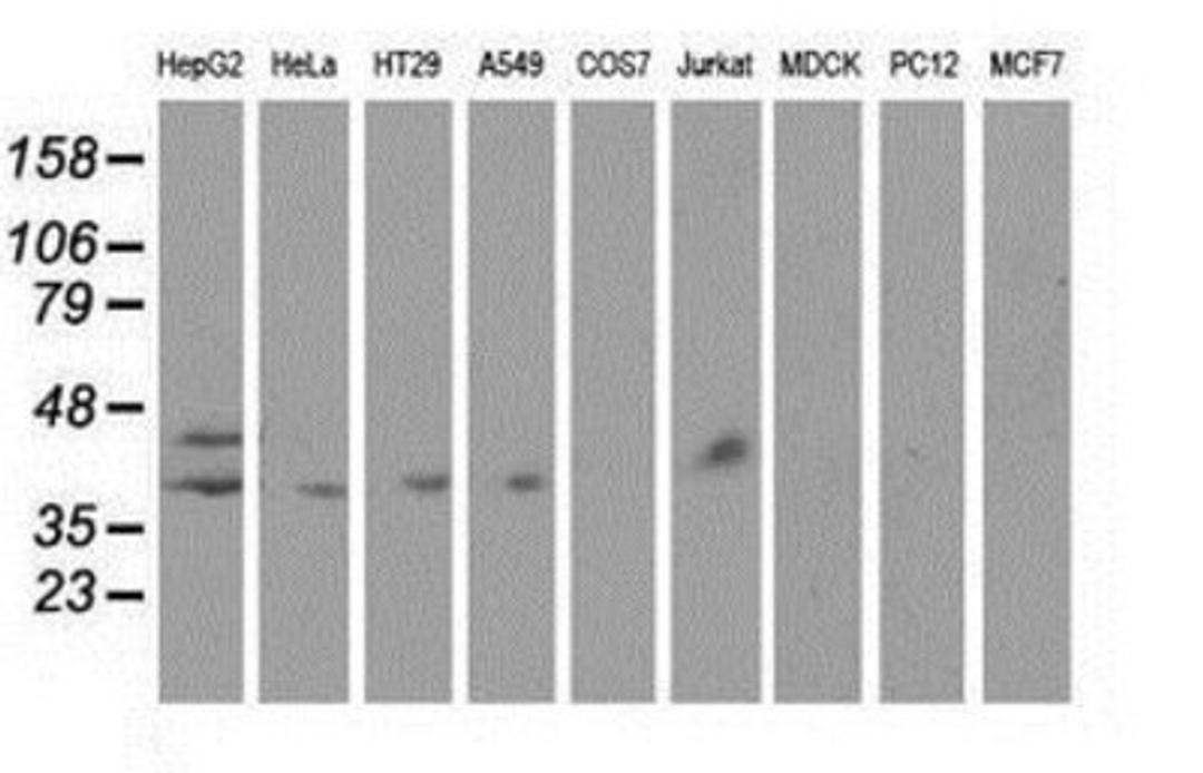 Western Blot: Haptoglobin Antibody (4H5) [NBP2-03008] Analysis of extracts (35ug) from 9 different cell lines by using anti-Haptoglobin monoclonal antibody.