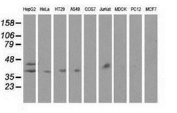 Western Blot: Haptoglobin Antibody (4H5) [NBP2-03008] Analysis of extracts (35ug) from 9 different cell lines by using anti-Haptoglobin monoclonal antibody.