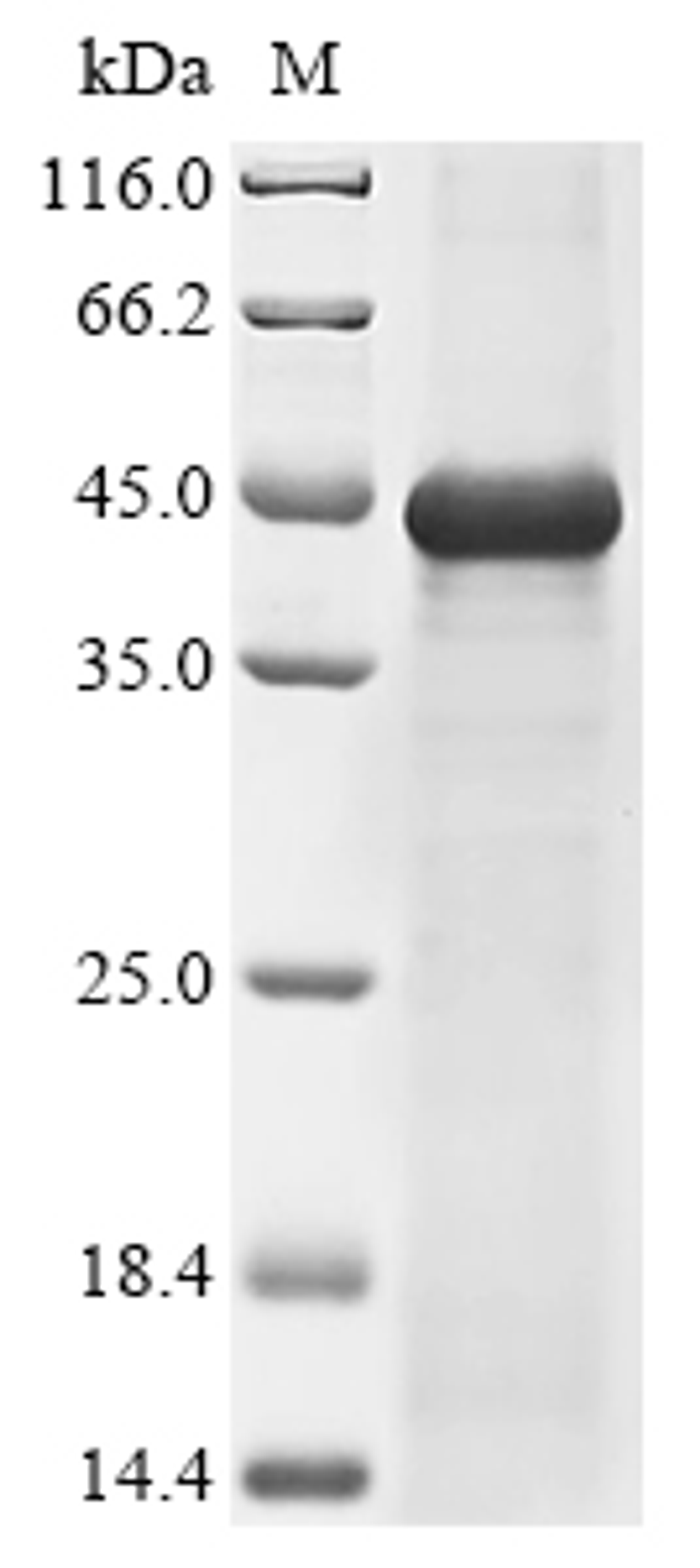 (Tris-Glycine gel) Discontinuous SDS-PAGE (reduced) with 5% enrichment gel and 15% separation gel.