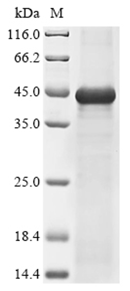 (Tris-Glycine gel) Discontinuous SDS-PAGE (reduced) with 5% enrichment gel and 15% separation gel.