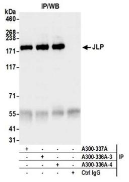 Detection of human JLP by western blot of immunoprecipitates.