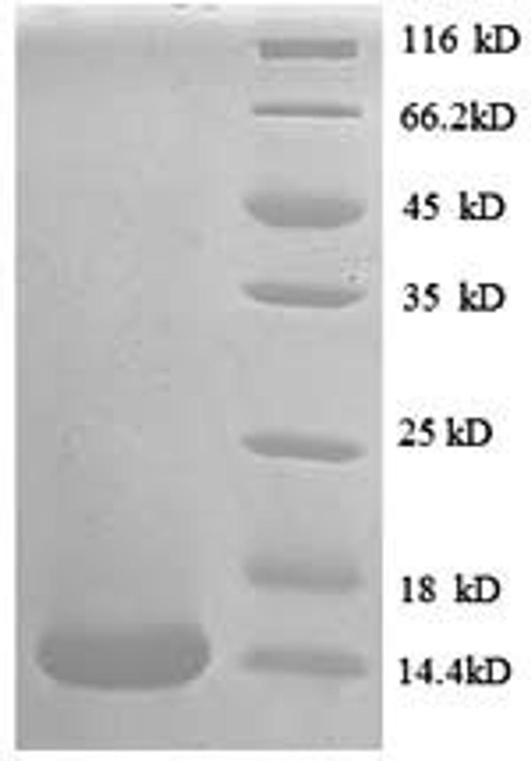 (Tris-Glycine gel) Discontinuous SDS-PAGE (reduced) with 5% enrichment gel and 15% separation gel.