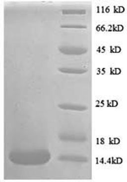 (Tris-Glycine gel) Discontinuous SDS-PAGE (reduced) with 5% enrichment gel and 15% separation gel.