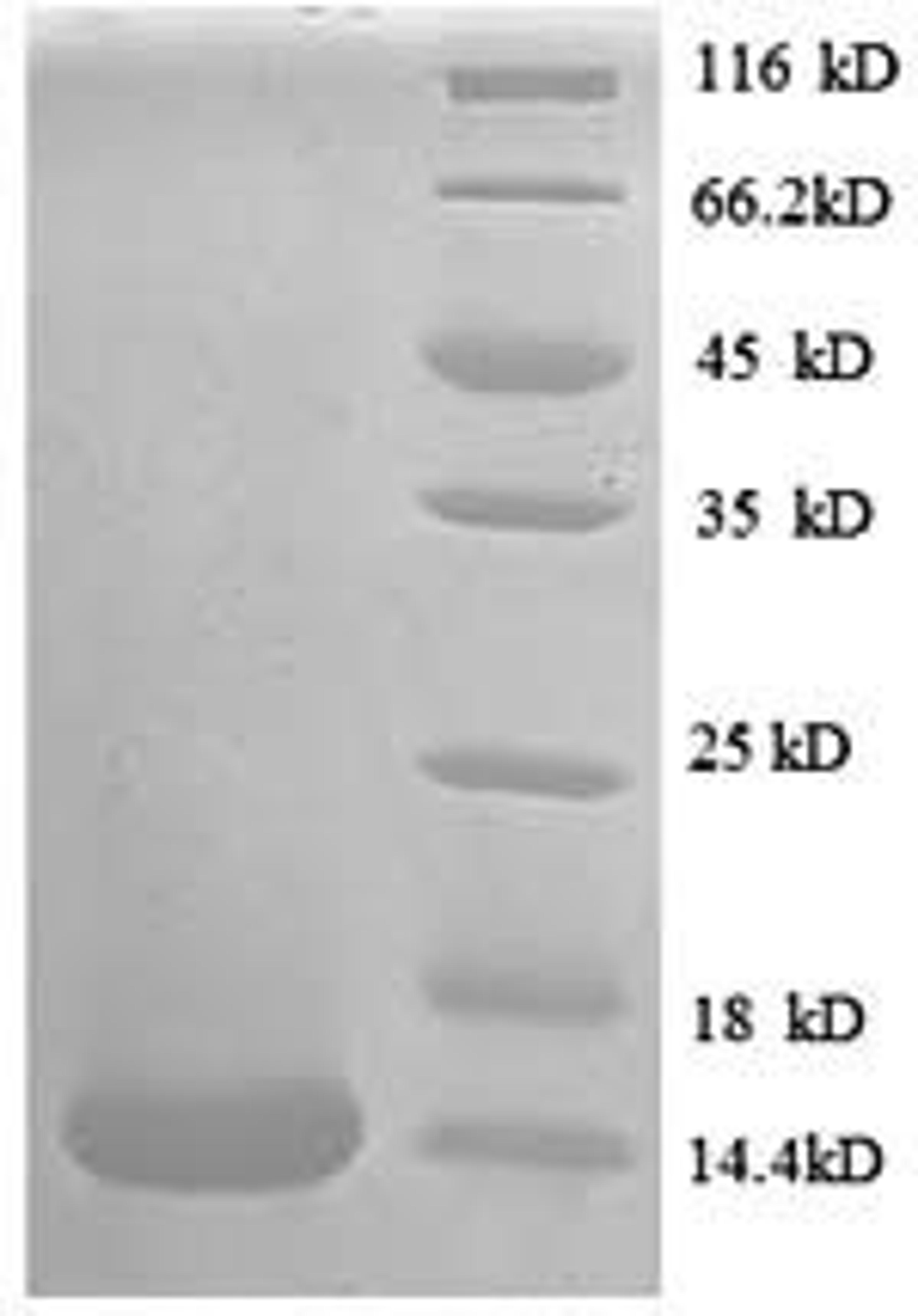 (Tris-Glycine gel) Discontinuous SDS-PAGE (reduced) with 5% enrichment gel and 15% separation gel.