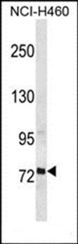 Western blot analysis of NCI-H460 cell line lysates (35ug/lane)using RFX2 antibody (primary antibody dilution at: 1:1000)