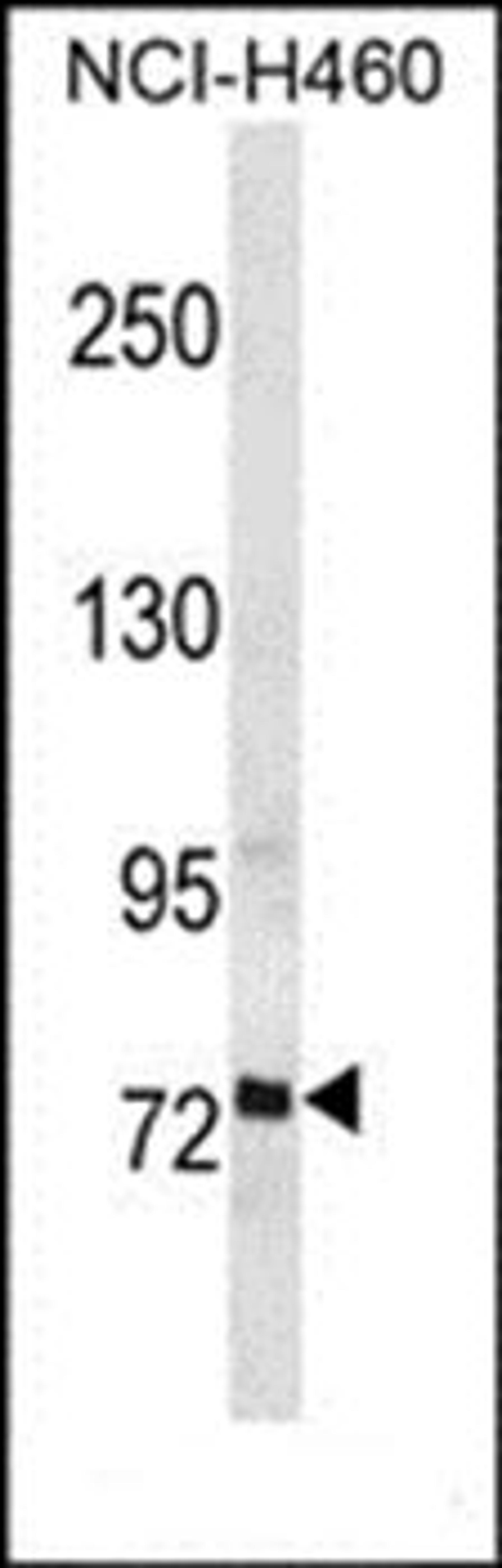 Western blot analysis of NCI-H460 cell line lysates (35ug/lane)using RFX2 antibody (primary antibody dilution at: 1:1000)