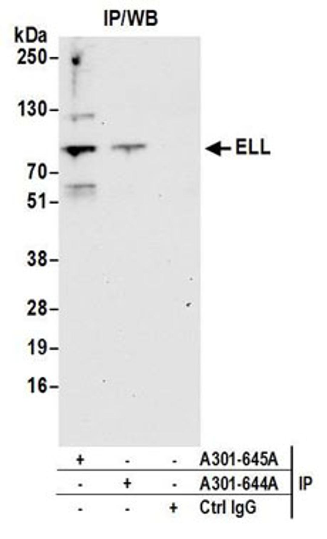 Detection of human ELL by western blot of immunoprecipitates.