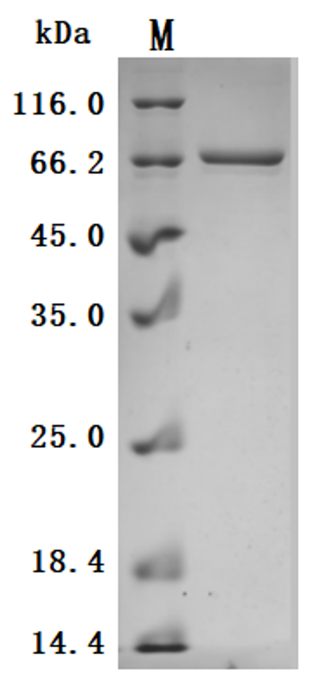 (Tris-Glycine gel) Discontinuous SDS-PAGE (reduced) with 5% enrichment gel and 15% separation gel.