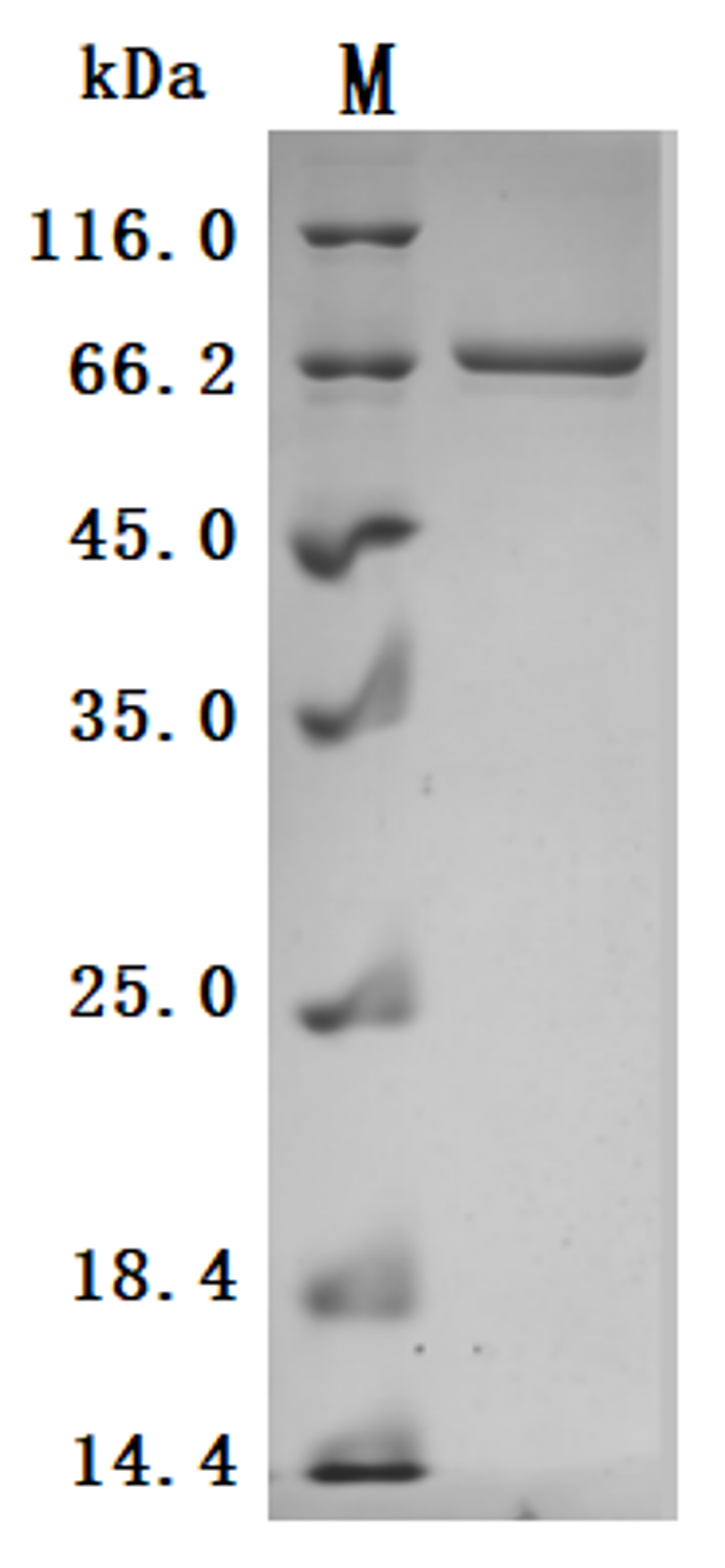 (Tris-Glycine gel) Discontinuous SDS-PAGE (reduced) with 5% enrichment gel and 15% separation gel.