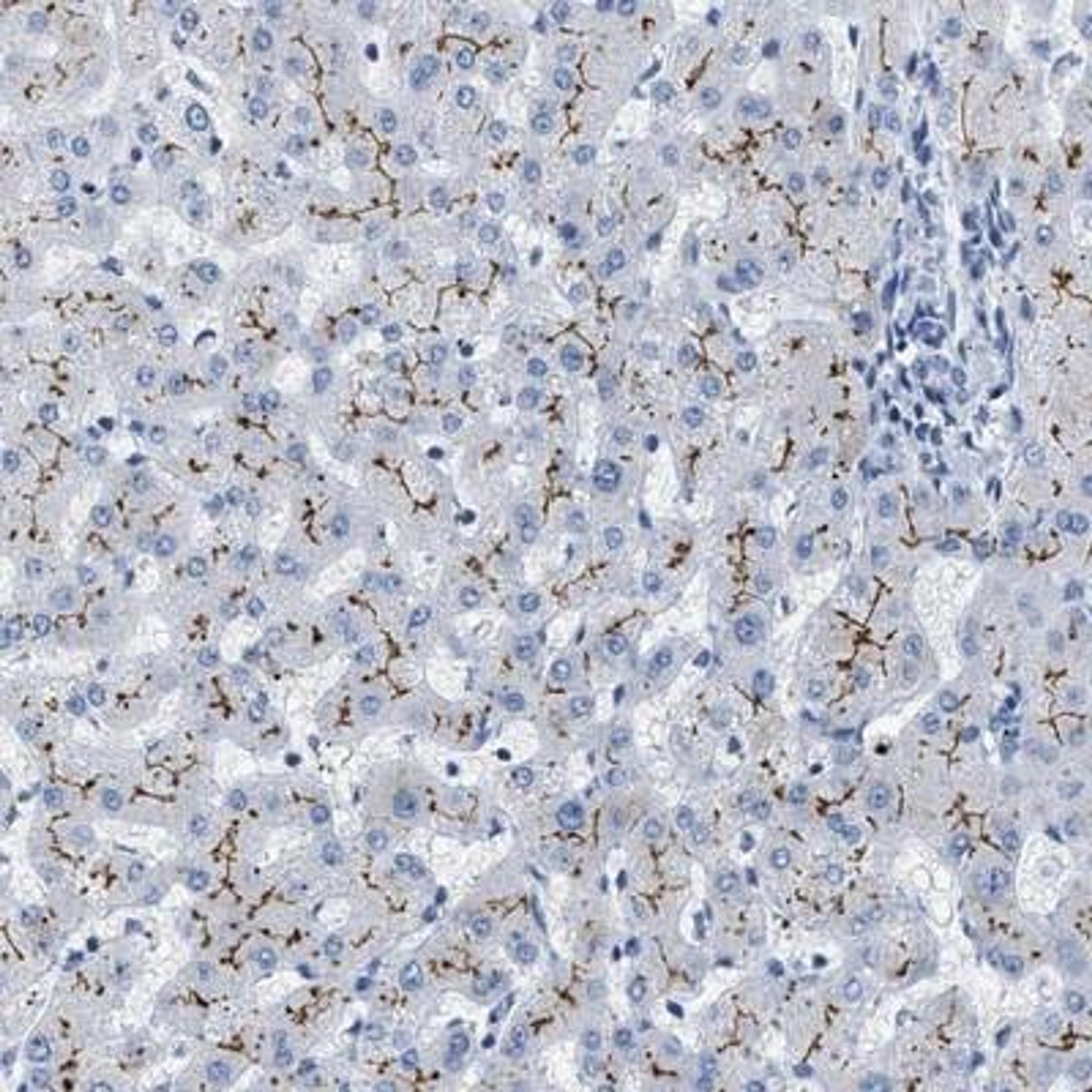 Immunohistochemistry: ABCB11 Antibody [NBP1-89319] - Staining of human liver shows moderate membranous positivity in hepatocytes.