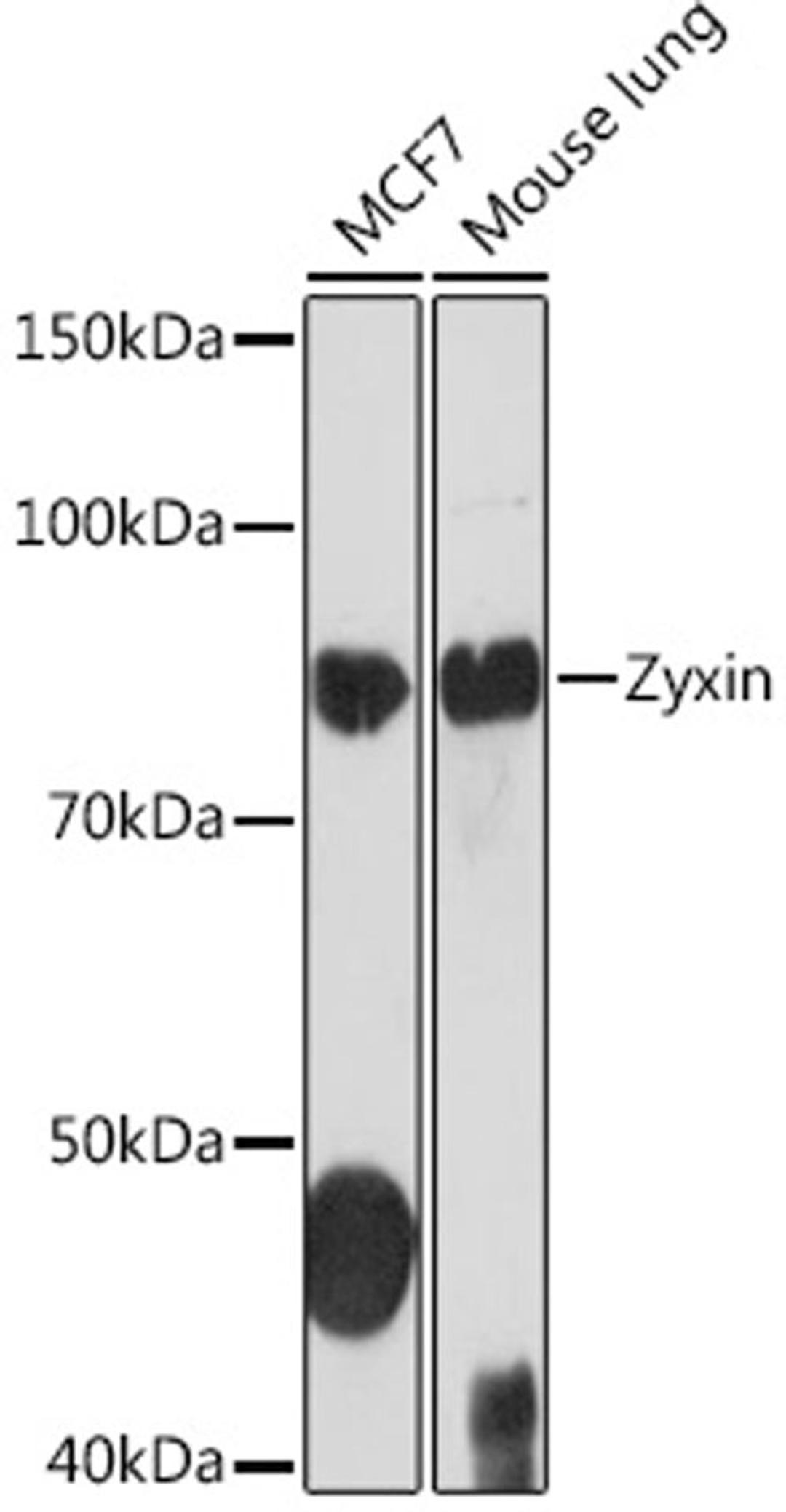 Western blot - Zyxin Rabbit mAb (A2298)