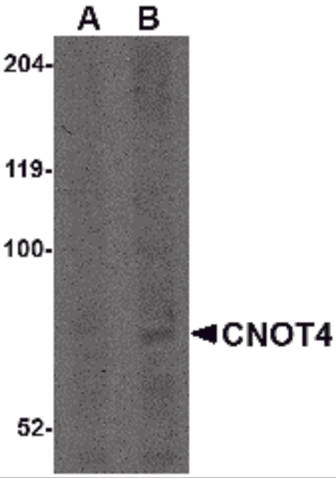 Western blot analysis of CNOT4 in A549 lysate with CNOT4 antibody at (A) 1 and (B) 2 &#956;g/mL.