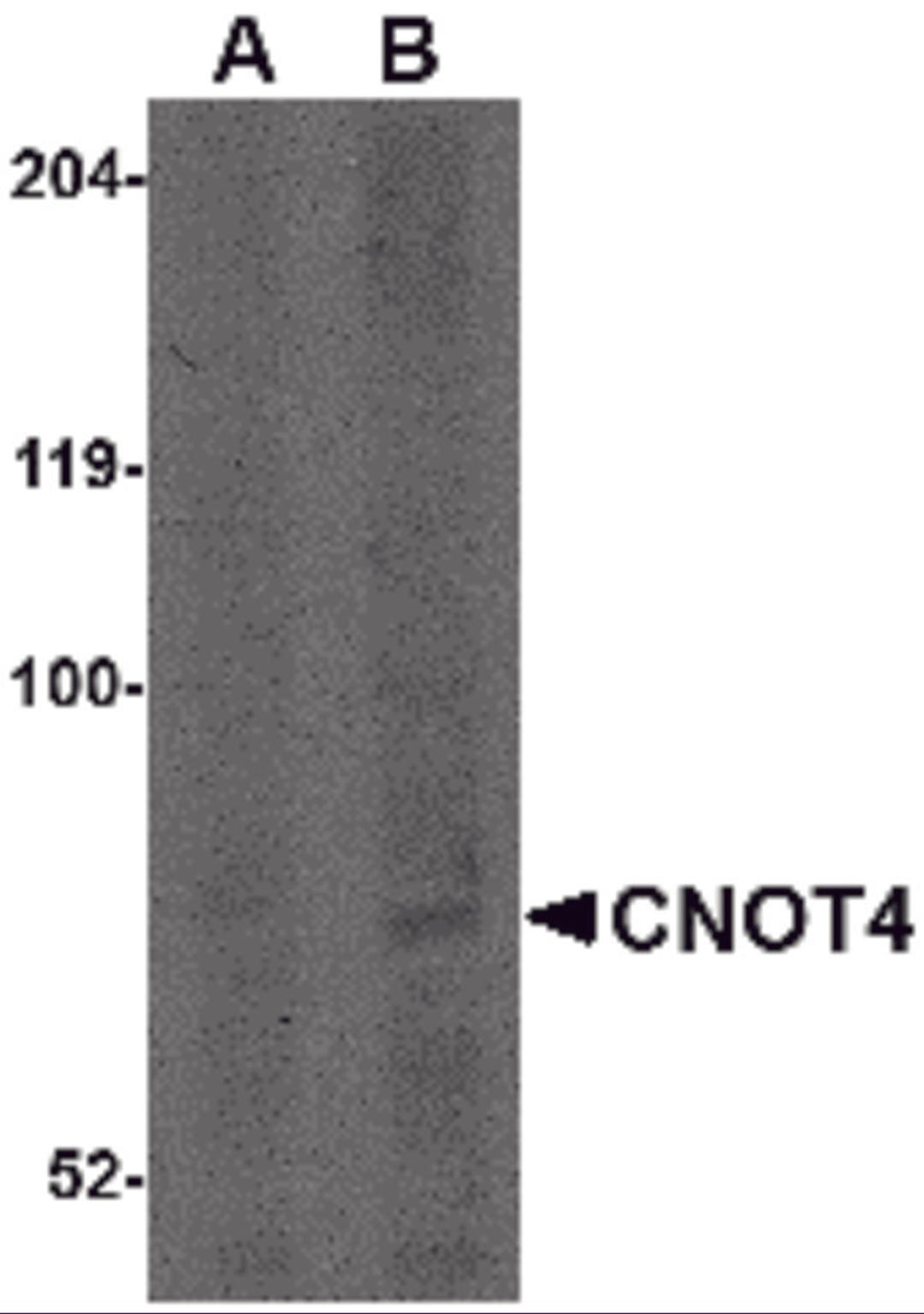 Western blot analysis of CNOT4 in A549 lysate with CNOT4 antibody at (A) 1 and (B) 2 μg/mL.