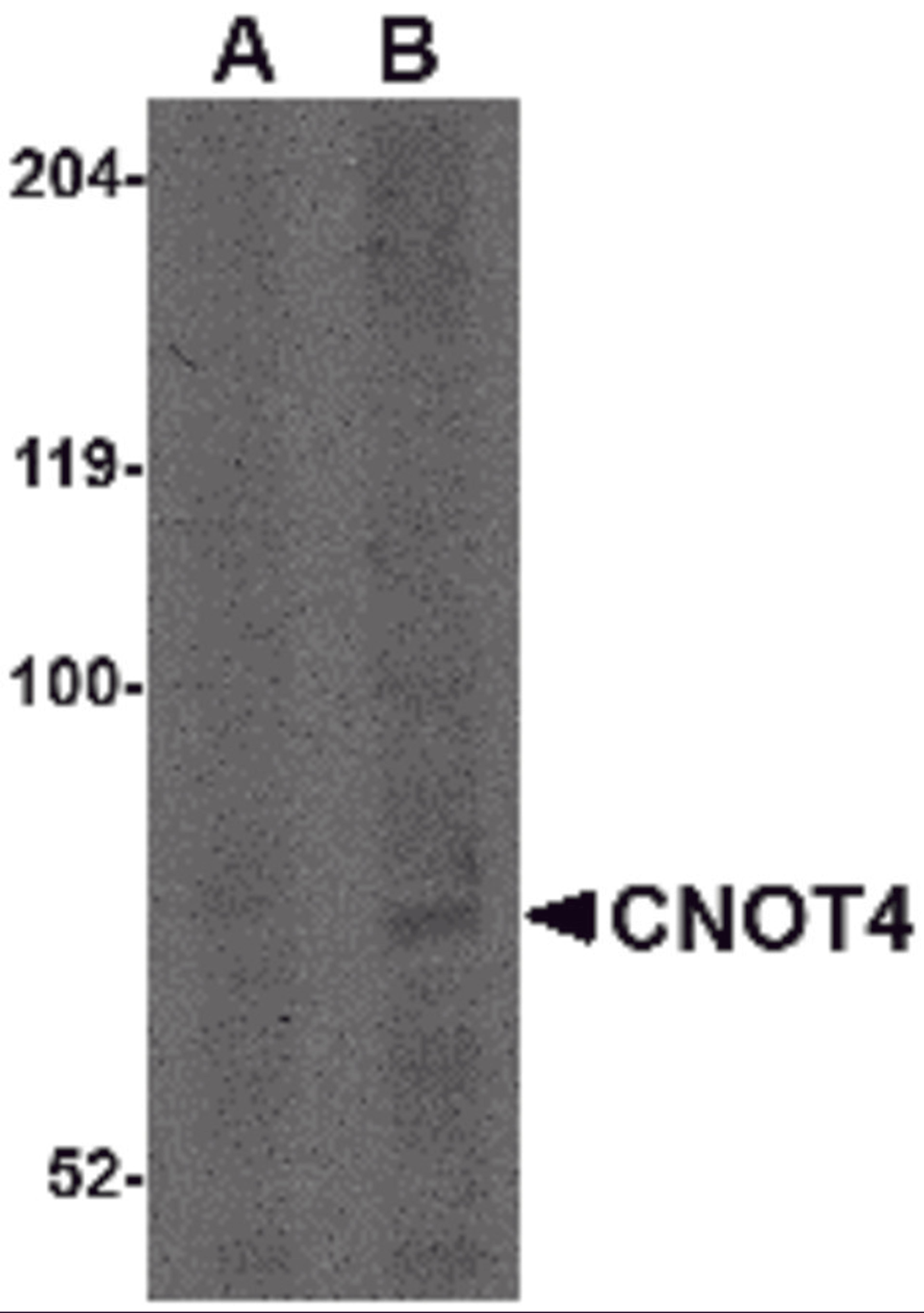 Western blot analysis of CNOT4 in A549 lysate with CNOT4 antibody at (A) 1 and (B) 2 μg/mL.