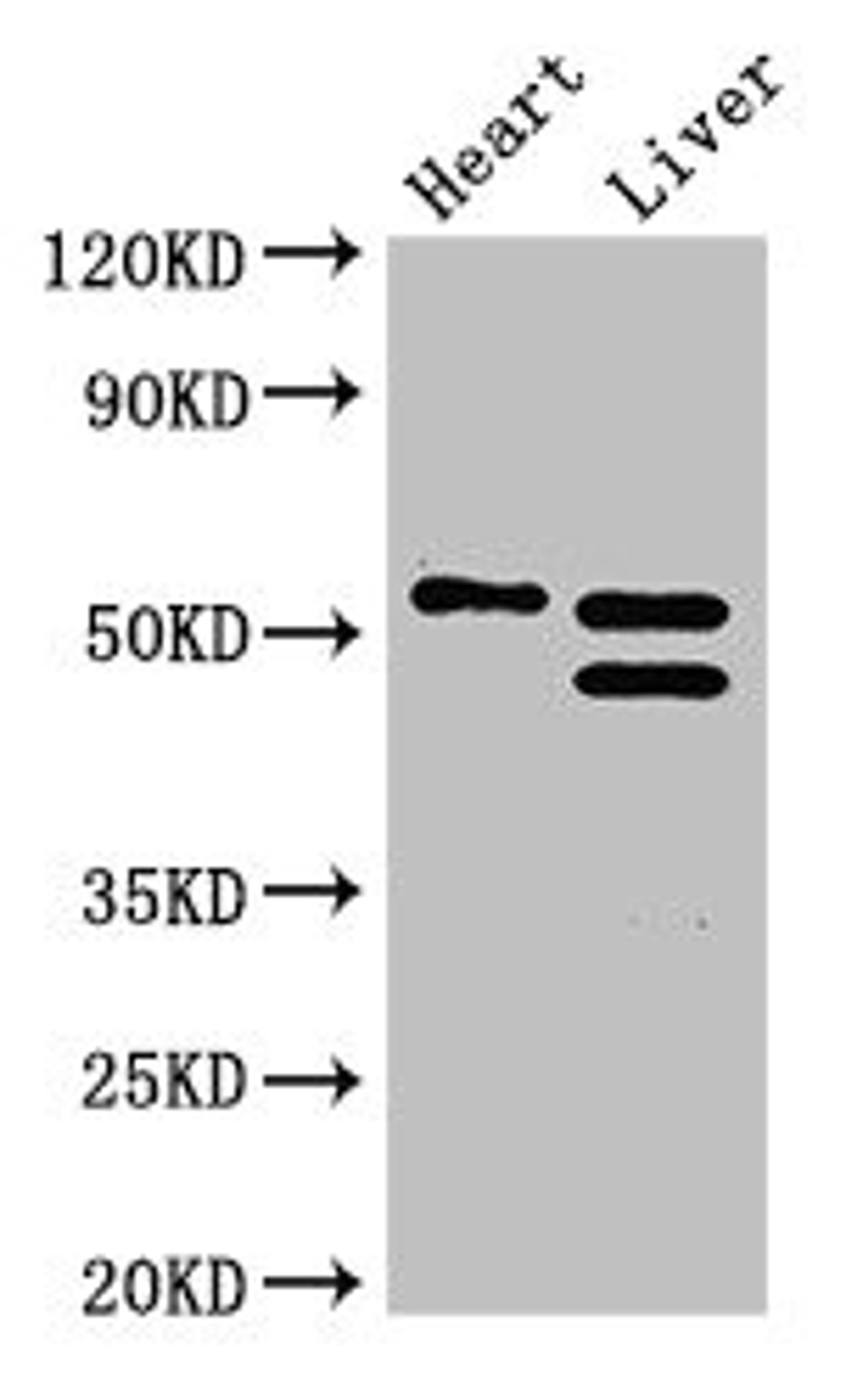 Western Blot. Positive WB detected in: Mouse heart tissue, Mouse liver tissue. All lanes: COQ6 antibody at 3ug/ml. Secondary. Goat polyclonal to rabbit IgG at 1/50000 dilution. predicted band size: 51, 49, 43 kDa. observed band size: 51, 49 kDa.