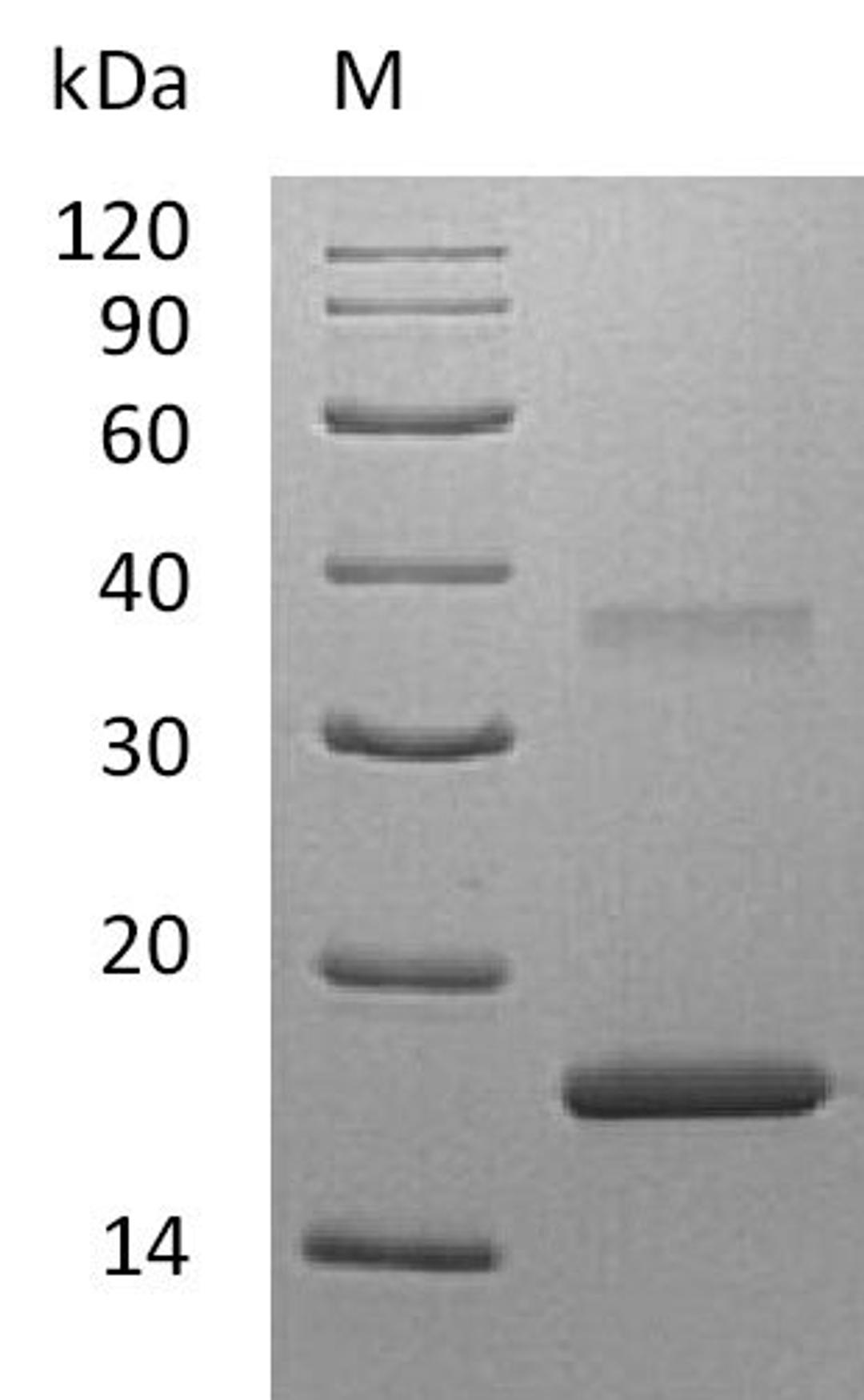 (Tris-Glycine gel) Discontinuous SDS-PAGE (reduced) with 5% enrichment gel and 15% separation gel.