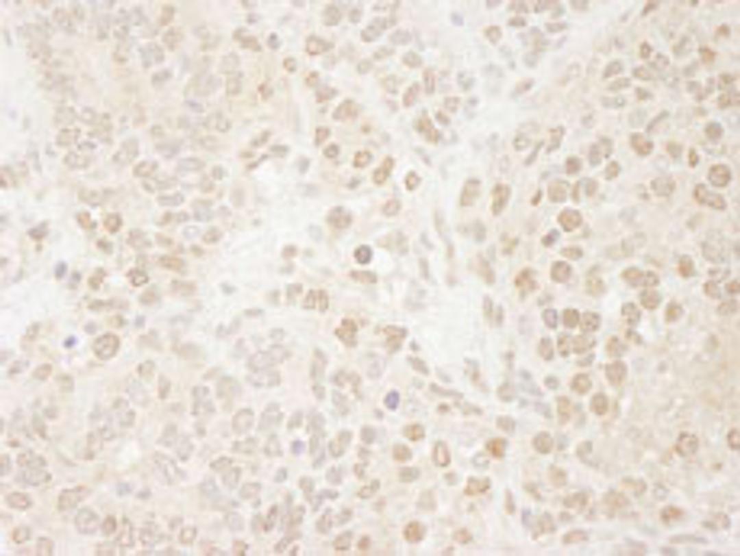 Detection of mouse Drosha by immunohistochemistry.