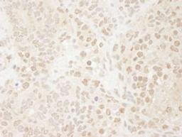 Detection of mouse Drosha by immunohistochemistry.