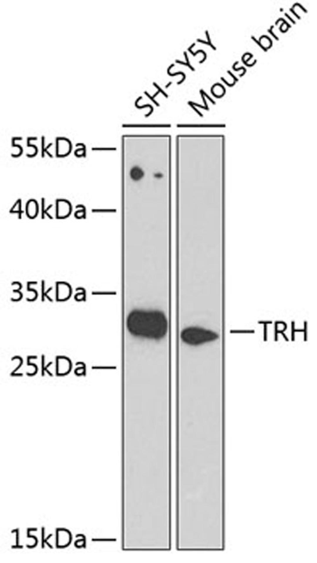 Western blot - TRH antibody (A8322)