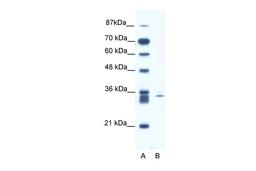 Antibody used in WB on Human Jurkat 1.25 ug/ml.