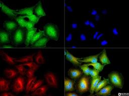 Immunocytochemistry/Immunofluorescence: Erythropoietin R Antibody [NBP1-19388] - EPO receptor antibody was tested in HeLa cells with DyLight 488 (green). Nuclei and alpha-tubulin were counterstained with DAPI (blue) and Dylight 550 (red).