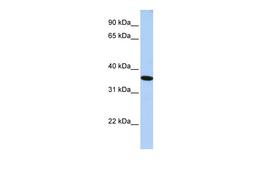 Antibody used in WB on Human HepG2 at 0.2-1 ug/ml.