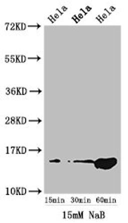 Western Blot. Positive WB detected in: Hela cell acid extracts treated by NaB. All lanes: HIST1H2AG antibody at 1.5µg/ml. Secondary. Goat polyclonal to rabbit IgG at 1/50000 dilution. Predicted band size: 15 kDa. Observed band size: 15 kDa