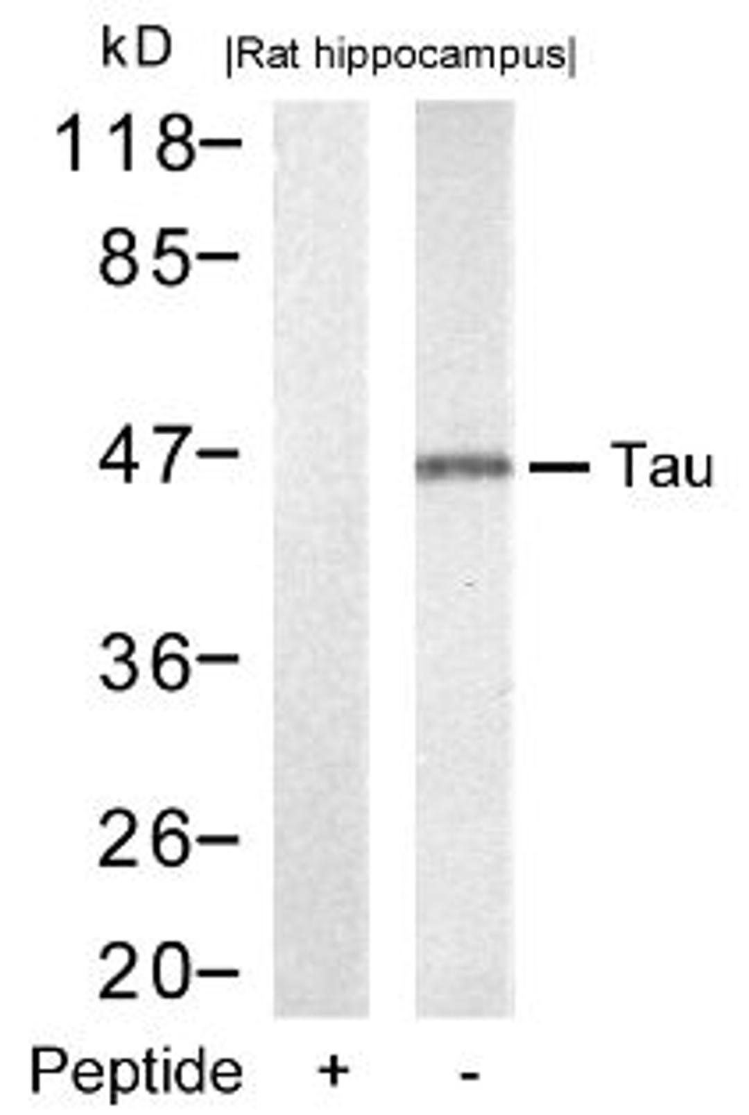 Western blot analysis of lysed extracts from rat hippocampus tissue using Tau (Ab-212).