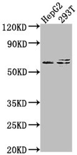 Western Blot. Positive WB detected in: HepG2 whole cell lysate, 293T whole cell lysate. All lanes: FZD7 antibody at 1:2000. Secondary. Goat polyclonal to rabbit IgG at 1/50000 dilution. Predicted band size: 64 kDa. Observed band size: 64 kDa.