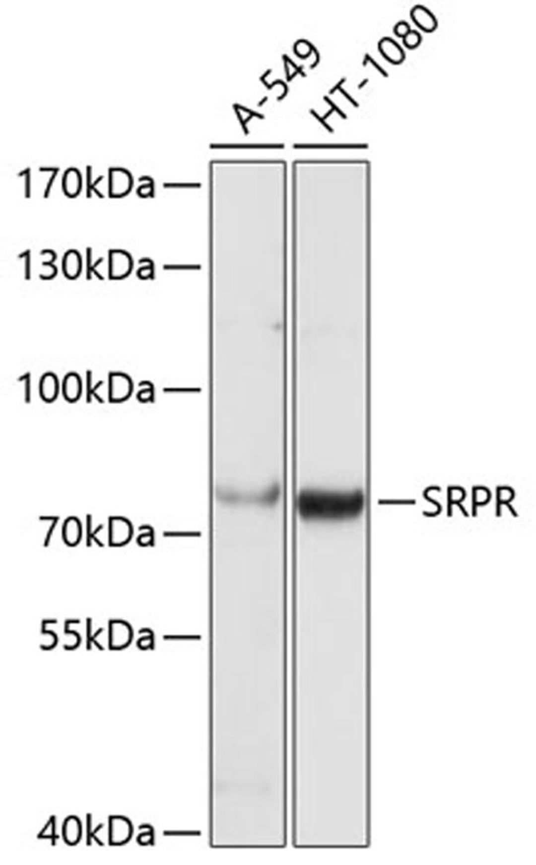 Western blot - SRPR antibody (A5939)