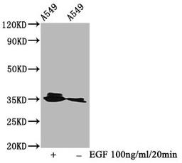 Western Blot. Positive WB detected in A549 whole cell lysate(treated with EGF or not). All lanes Phospho-PPP2CA antibody at 0.95μg/ml. Secondary. Goat polyclonal to rabbit IgG at 1/50000 dilution. Predicted band size: 35 KDa. Observed band size: 35 KDa. 