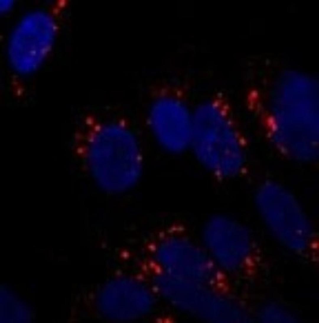 Immunocytochemistry/Immunofluorescence: ATG5 Antibody [NB110-53818] - Staining of SY5Y cells using NB110-53818 at 1:250. Incubated overnight at 4 degrees. Photo courtesy of an anonymous collaborator.