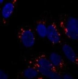 Immunocytochemistry/Immunofluorescence: ATG5 Antibody [NB110-53818] - Staining of SY5Y cells using NB110-53818 at 1:250. Incubated overnight at 4 degrees. Photo courtesy of an anonymous collaborator.