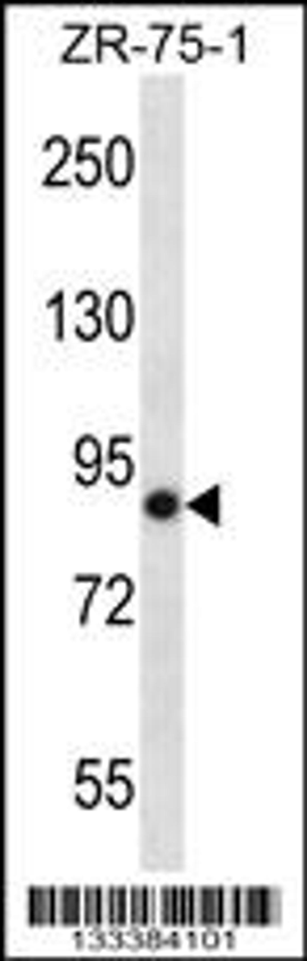 Western blot analysis in ZR-75-1 cell line lysates (35ug/lane).