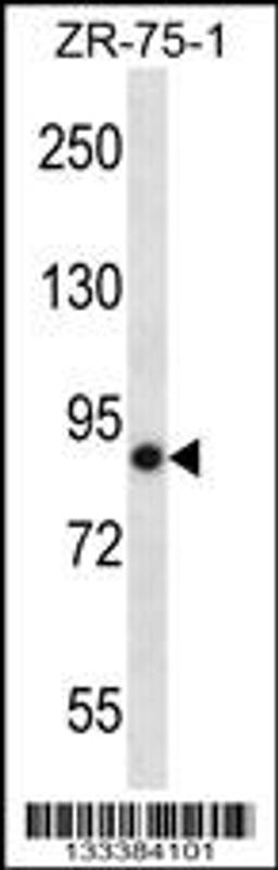 Western blot analysis in ZR-75-1 cell line lysates (35ug/lane).