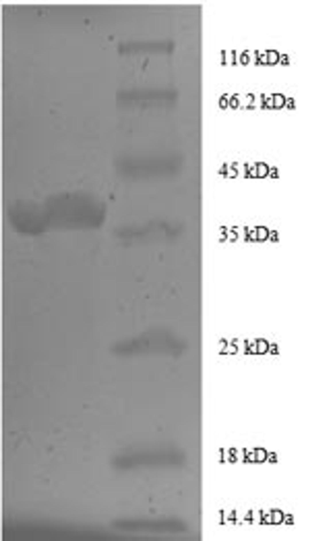 (Tris-Glycine gel) Discontinuous SDS-PAGE (reduced) with 5% enrichment gel and 15% separation gel.