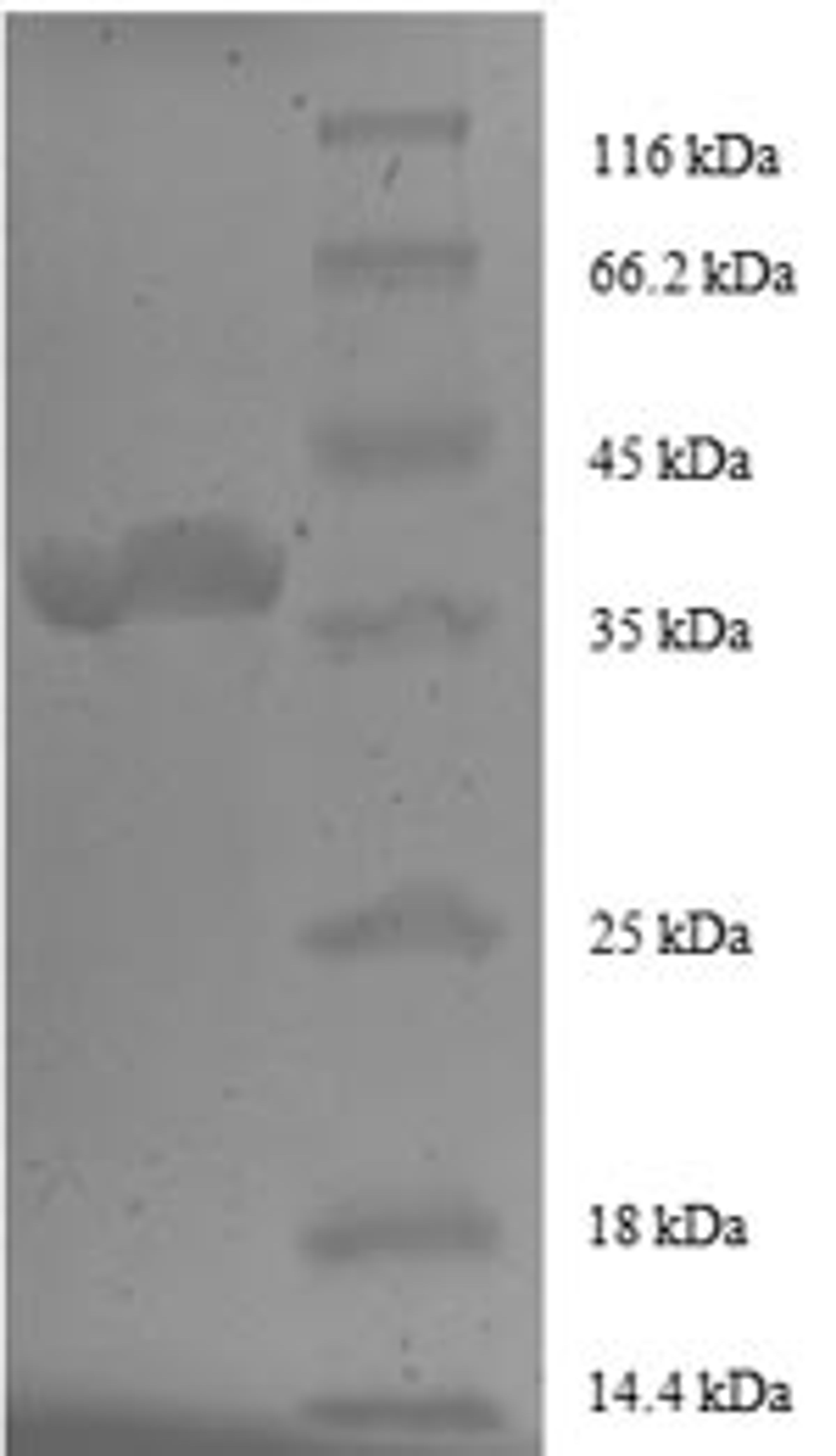 (Tris-Glycine gel) Discontinuous SDS-PAGE (reduced) with 5% enrichment gel and 15% separation gel.
