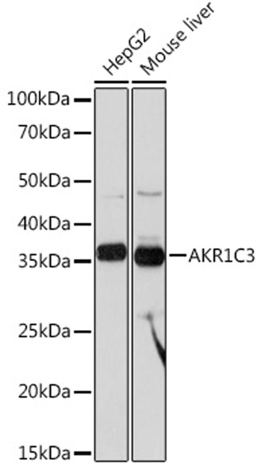 Western blot - AKR1C3 Rabbit mAb (A3884)