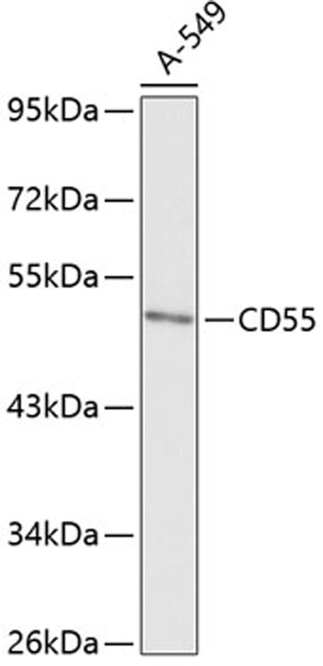 Western blot - CD55 antibody (A13918)