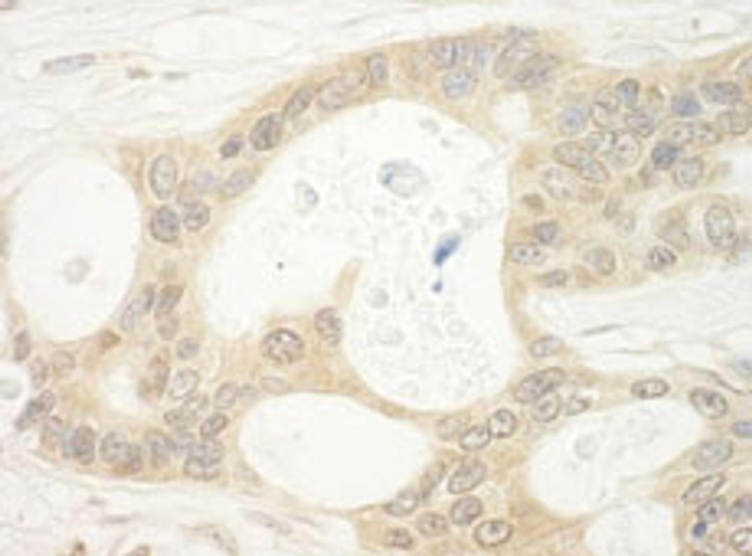 Detection of human BHD by immunohistochemistry.